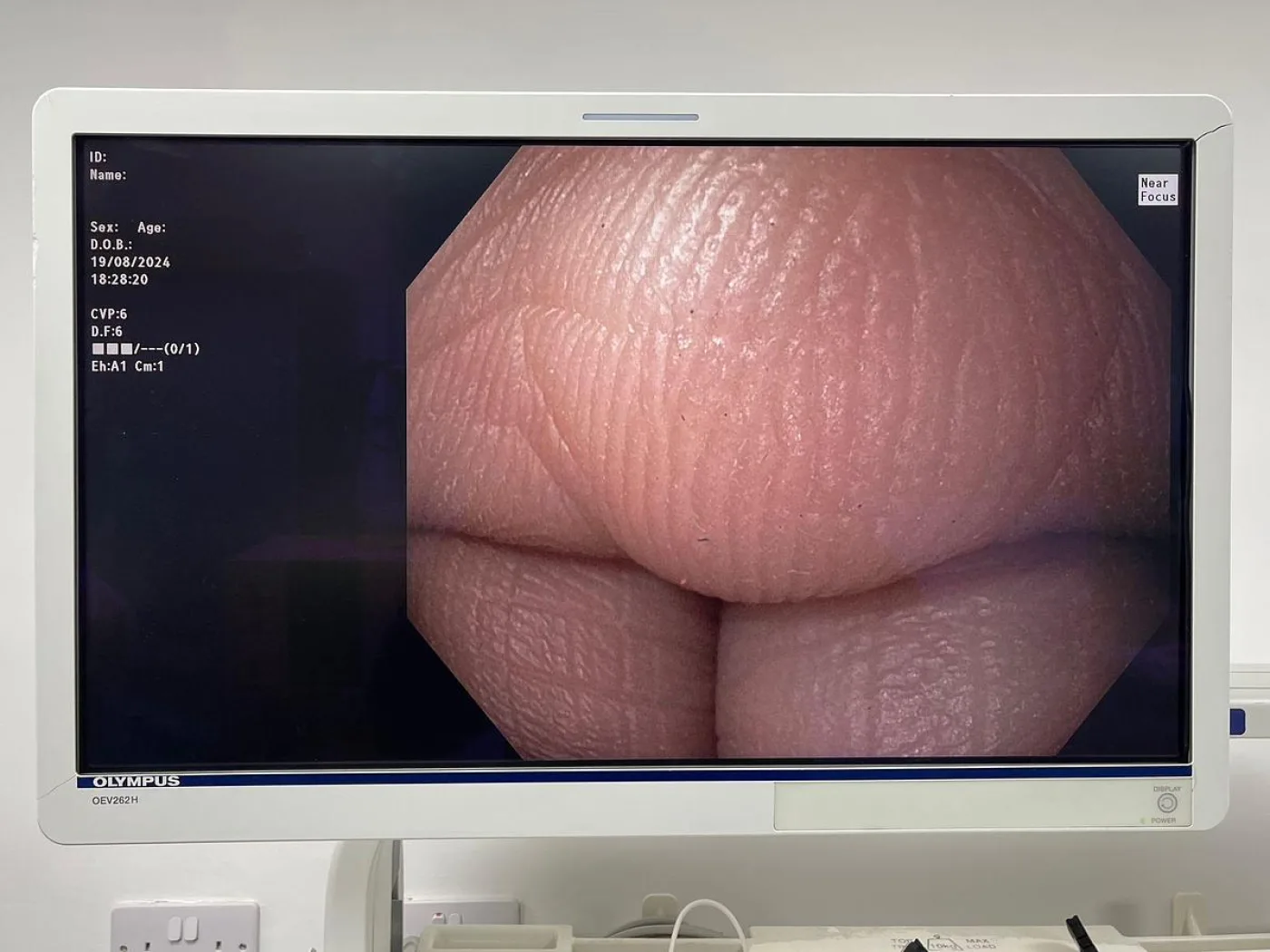 Olympus Evis Exera III series GIF-HQ190 Gastroscope - 4