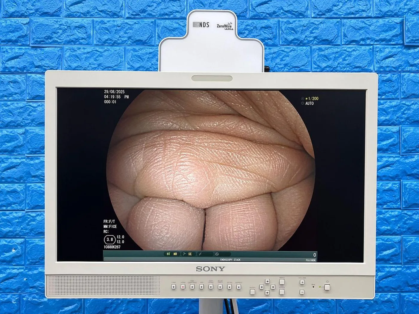 Fujinon VP-3500HD System with XL-4450 Light source Endoscopy System - 6