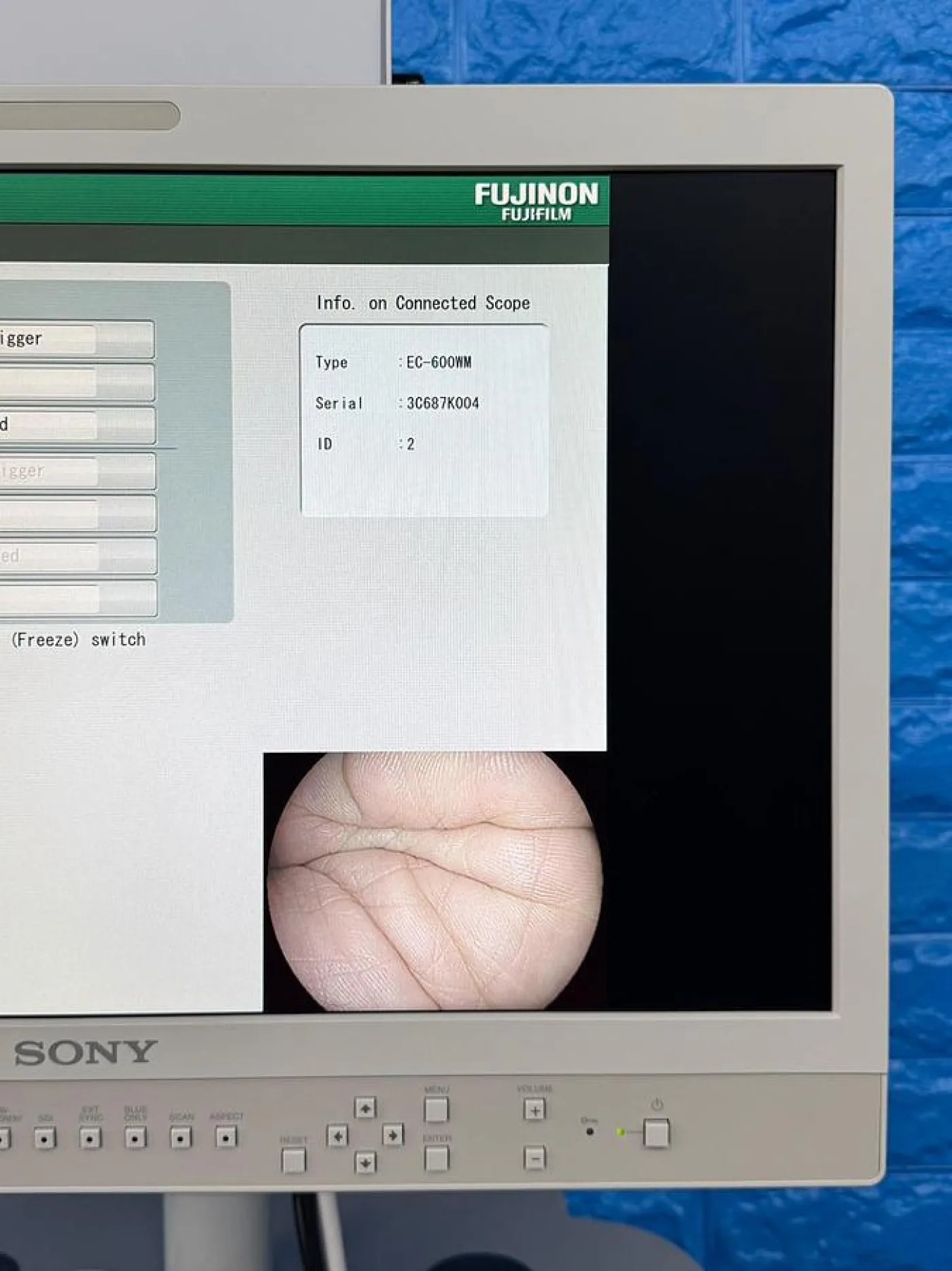 Fujinon Scope Model: EC-600WM - 4