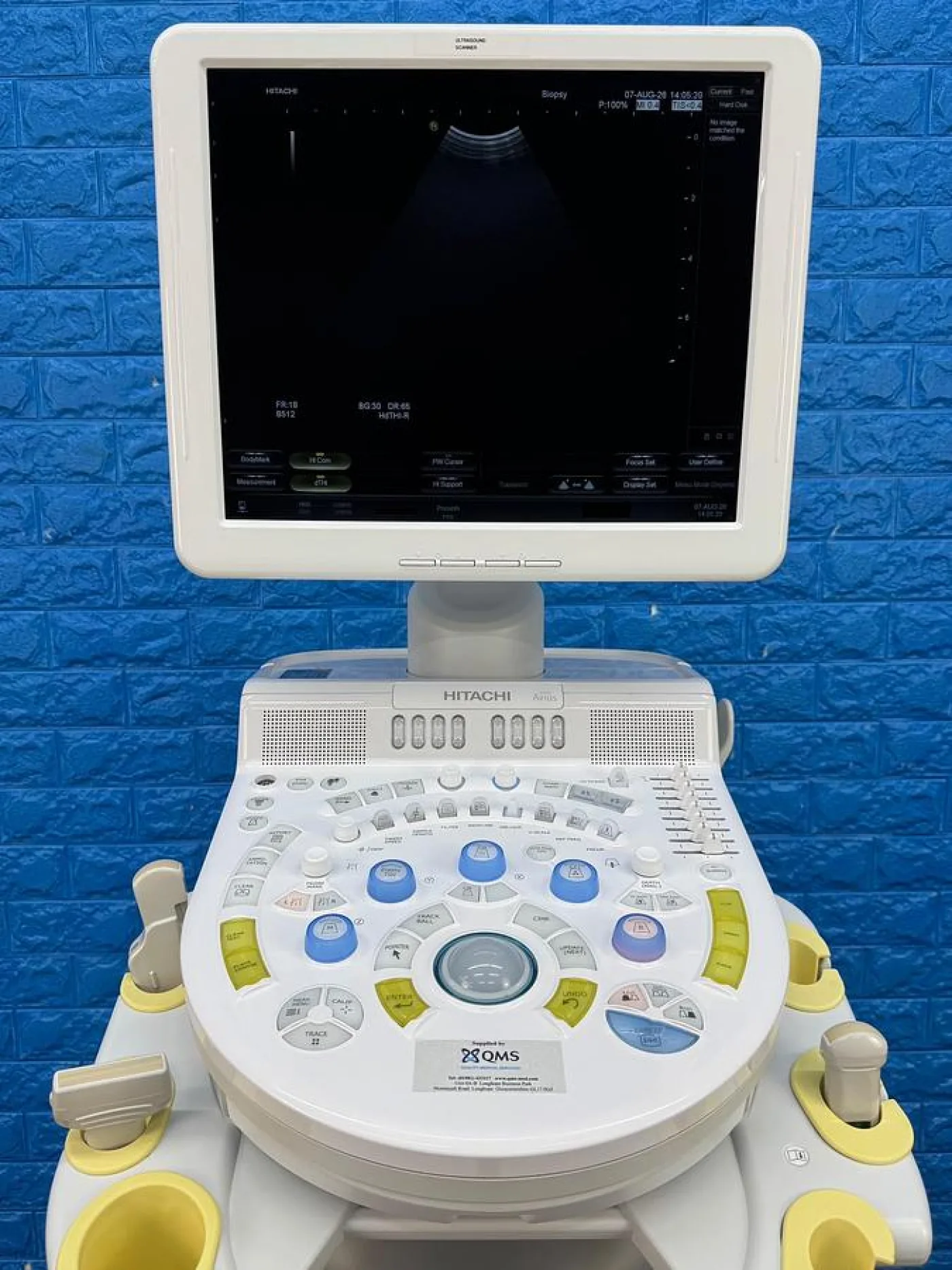Hitachi HI Vision Avius Ultrasound REF HI Vision Avius YOM: 2018 - 4