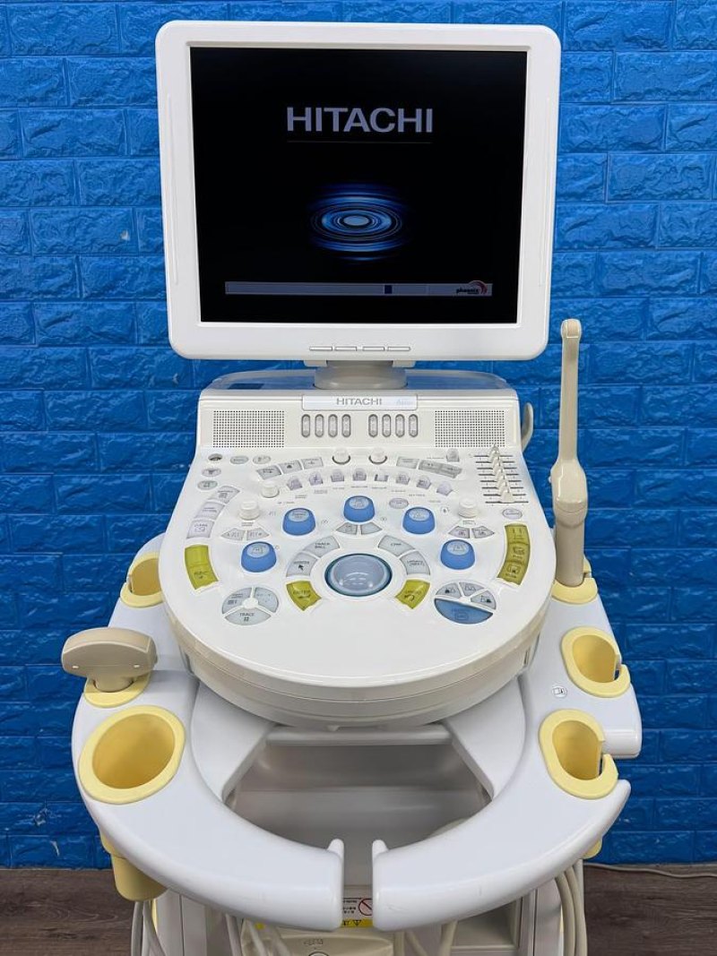 Hitachi HI Vision Avius Ultrasound YOM: 2011