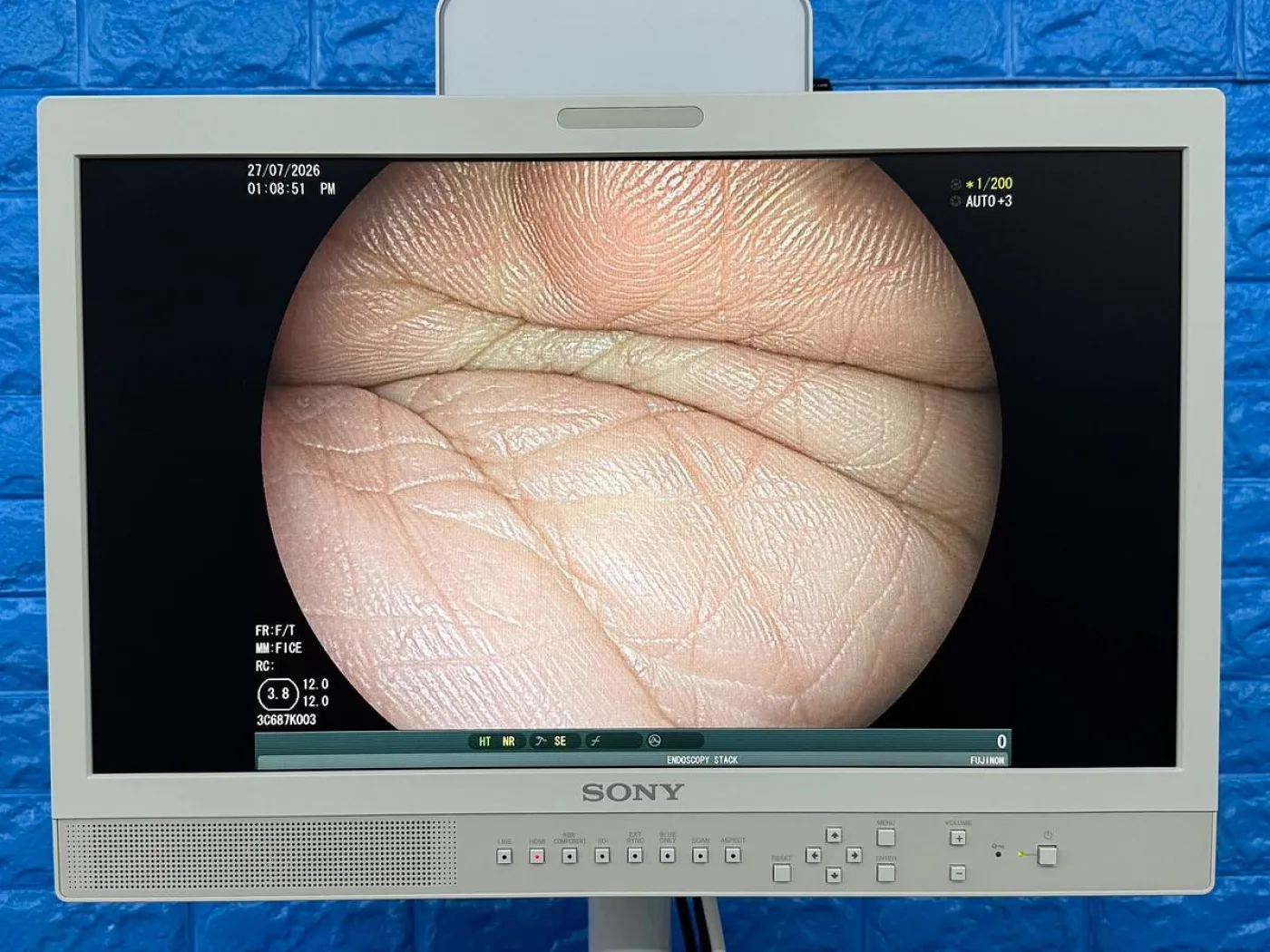 Fujinon Scope Model: EC-600WM - 1