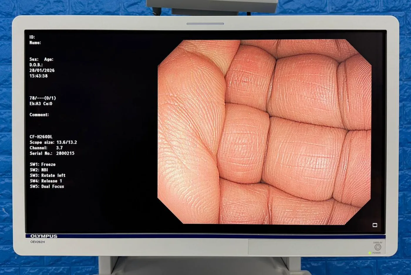 Olympus OEV262H LCD Monitor - 8