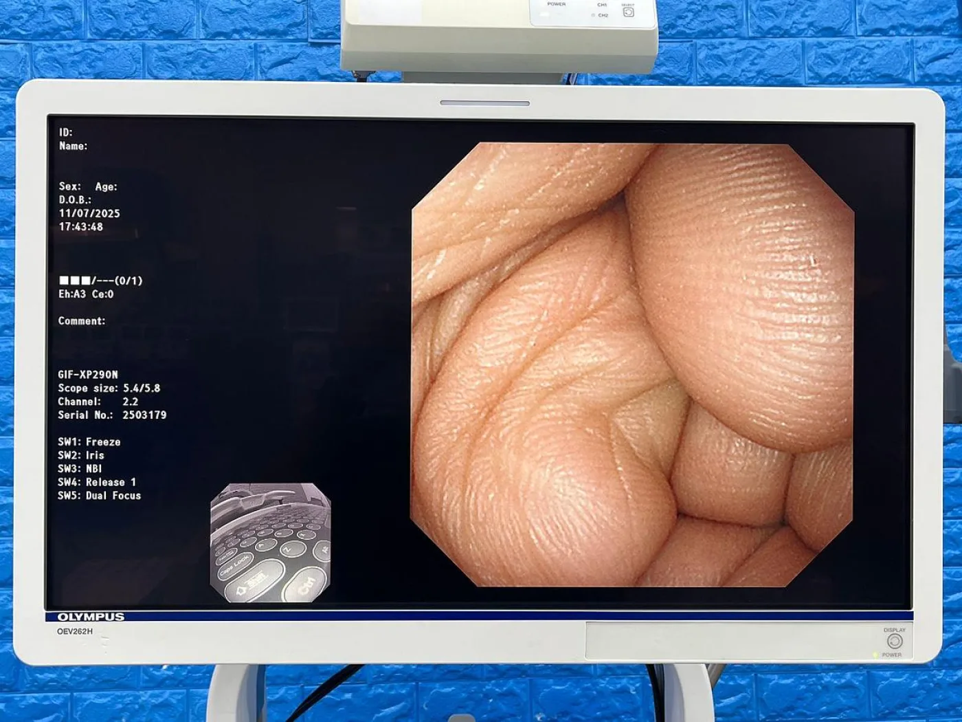 Olympus GIF-XP290N Gastroscope - 2