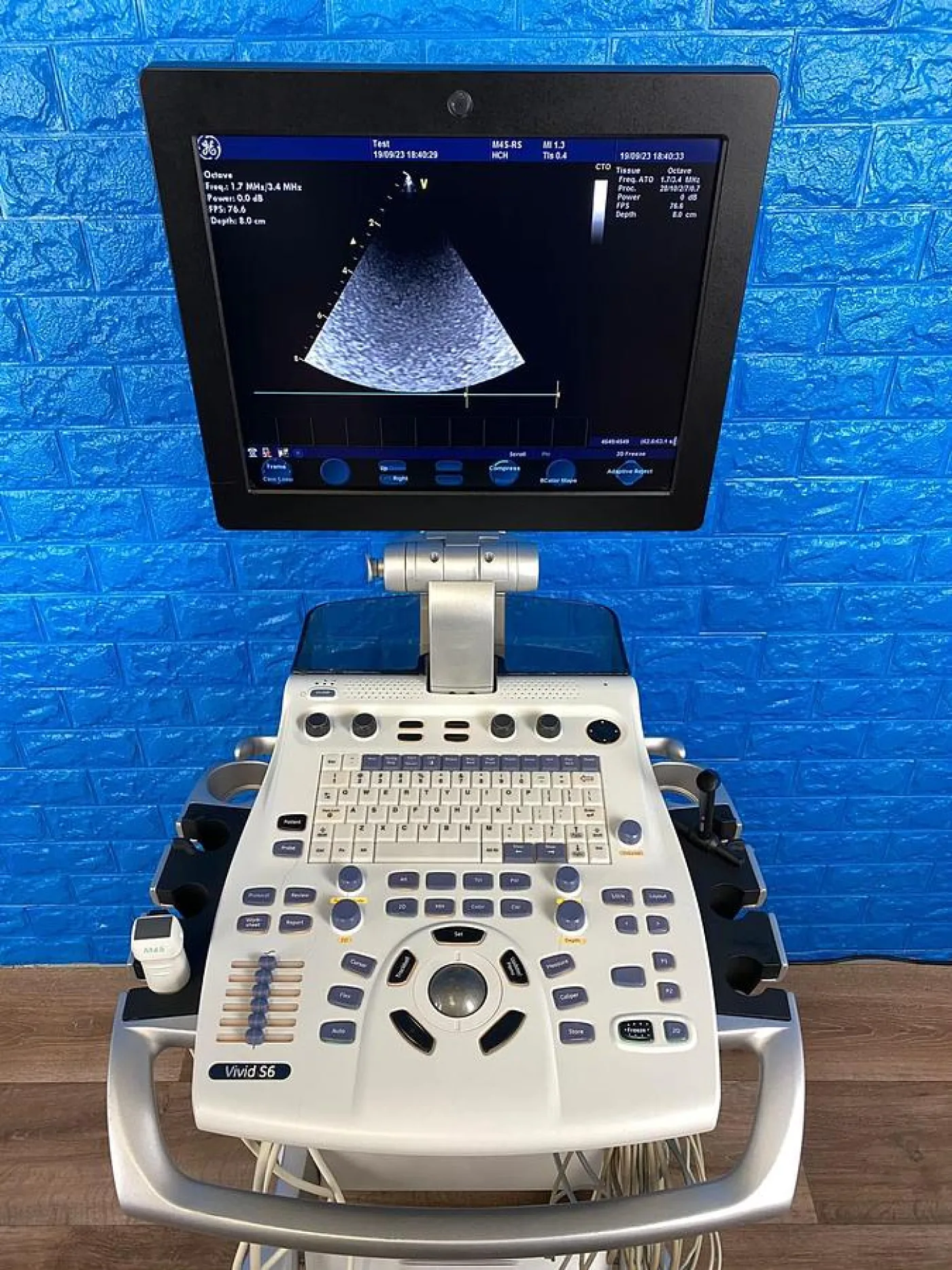 GE Vivid S6 Cardiovascular ultrasound system YOM: 2013 - 5