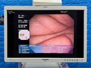 Olympus Scope Model: CF-Q260DL Colonoscope
