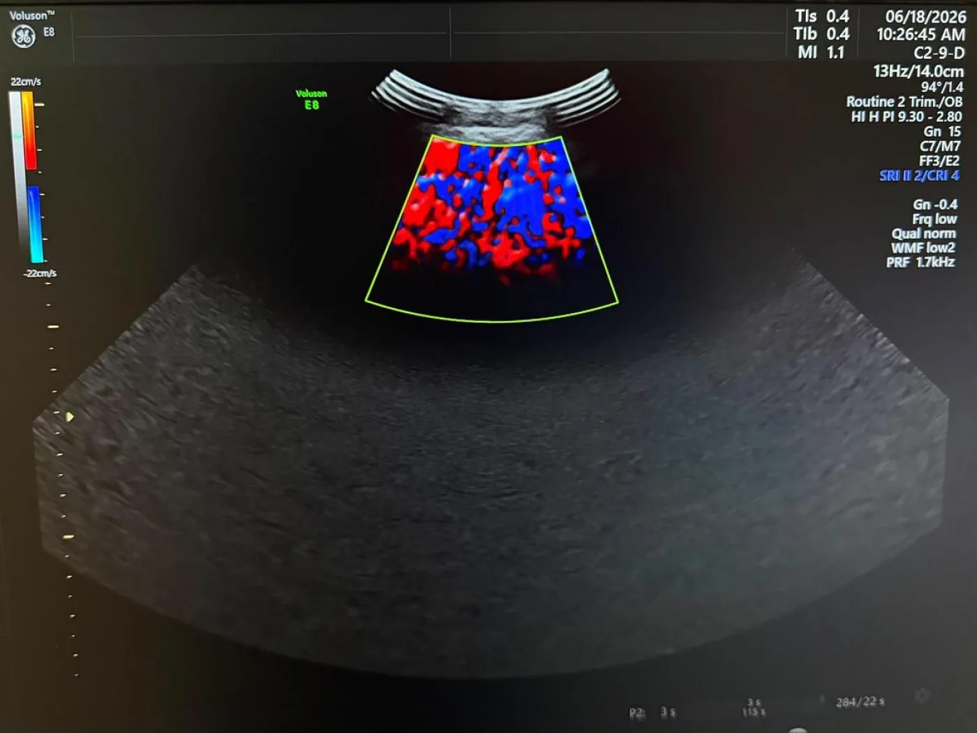 GE C2-9-D Probe REF: 5405253 YOM: 2019 - 3