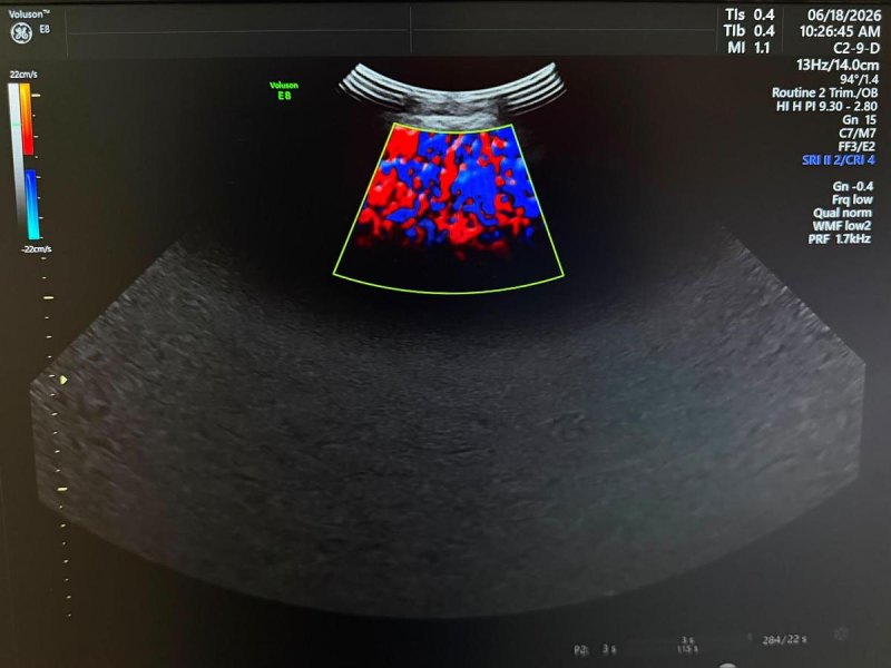 GE C2-9-D Probe REF: 5405253 YOM: 2019