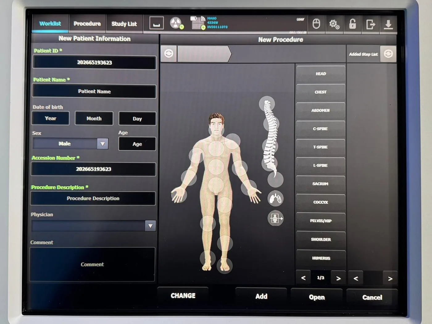 DRGEM TOPAZ-32D Mobile Xray with wireless detector 32kW 400mA YOM: 2020 - 7