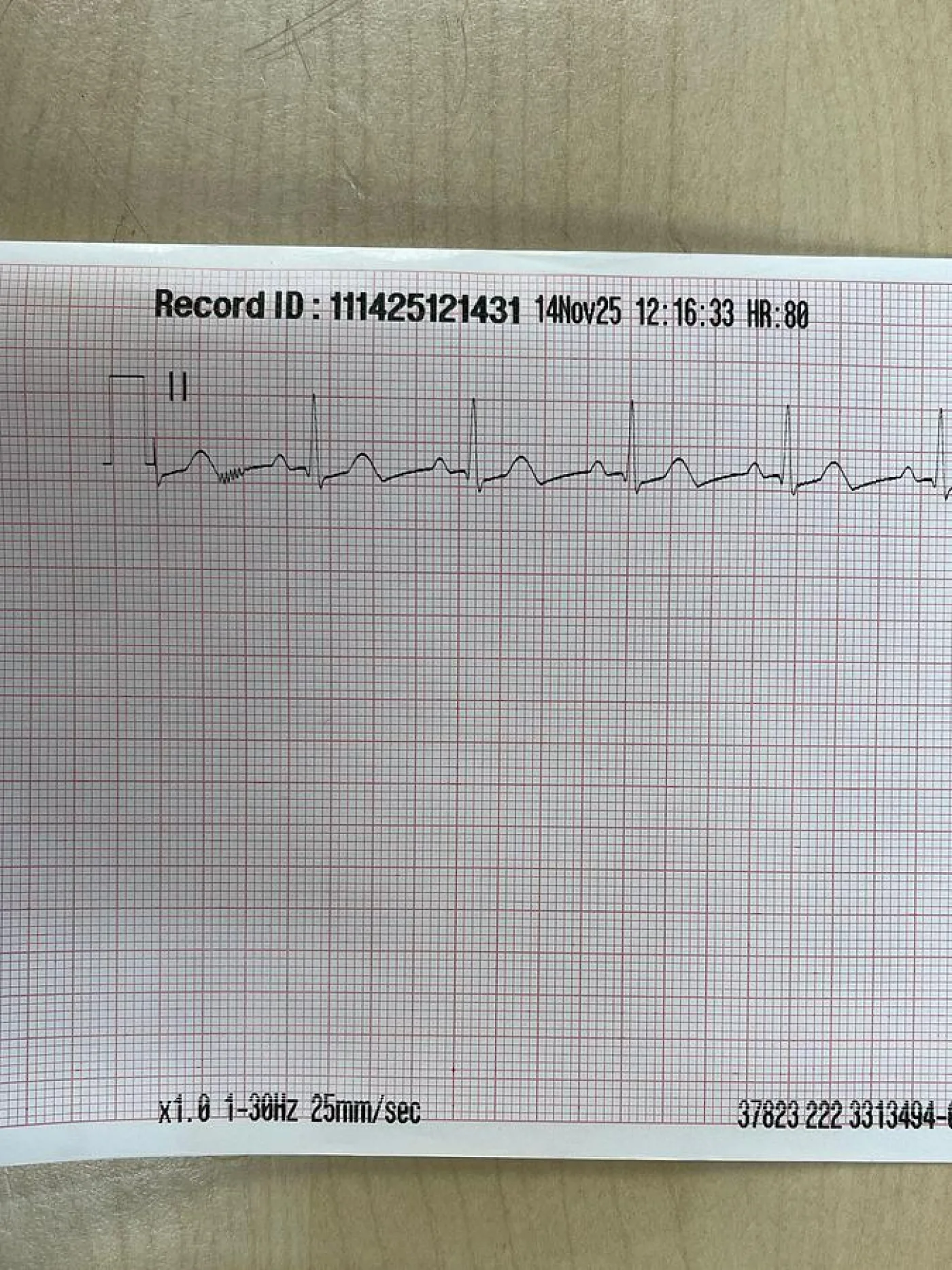 Physio-Control Lifepak 15 Monitor YOM: 2018 REF: 99577-001382 - 7