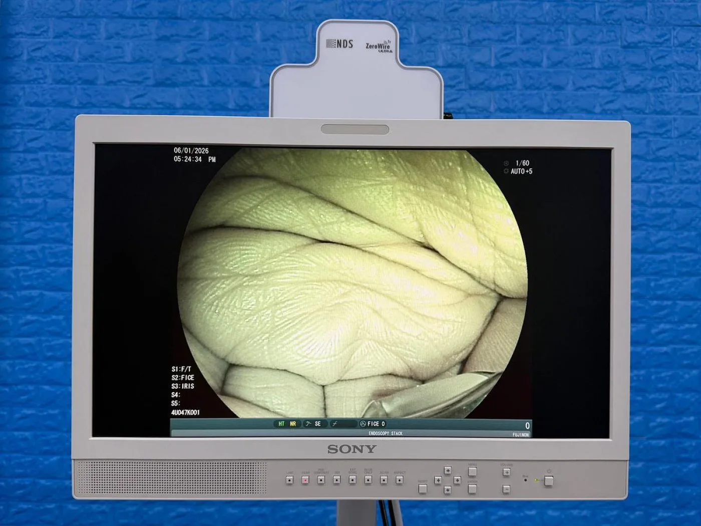 Fujinon Scope EG-580 UT Linear Ultrasonic Endoscope YOM: 2018 - 3