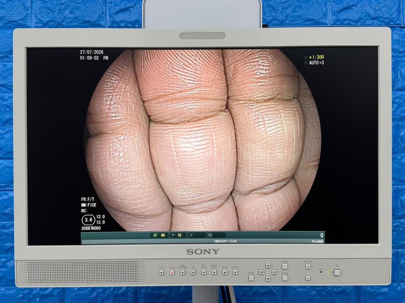 Fujinon Scope Model: EC-600WM
