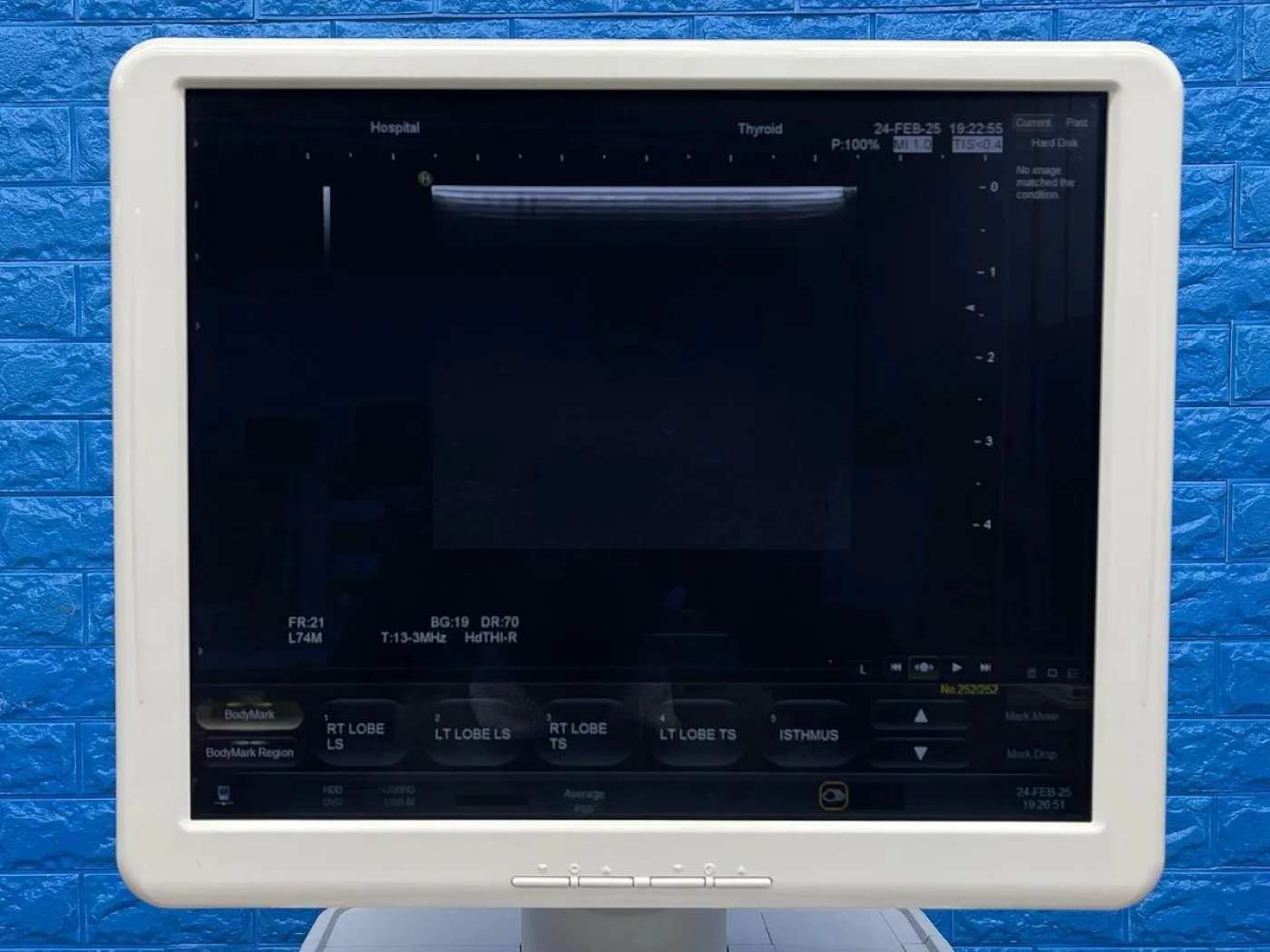 Hitachi HI VISION Ascendus Ultrasound YOM: 2016 - 5
