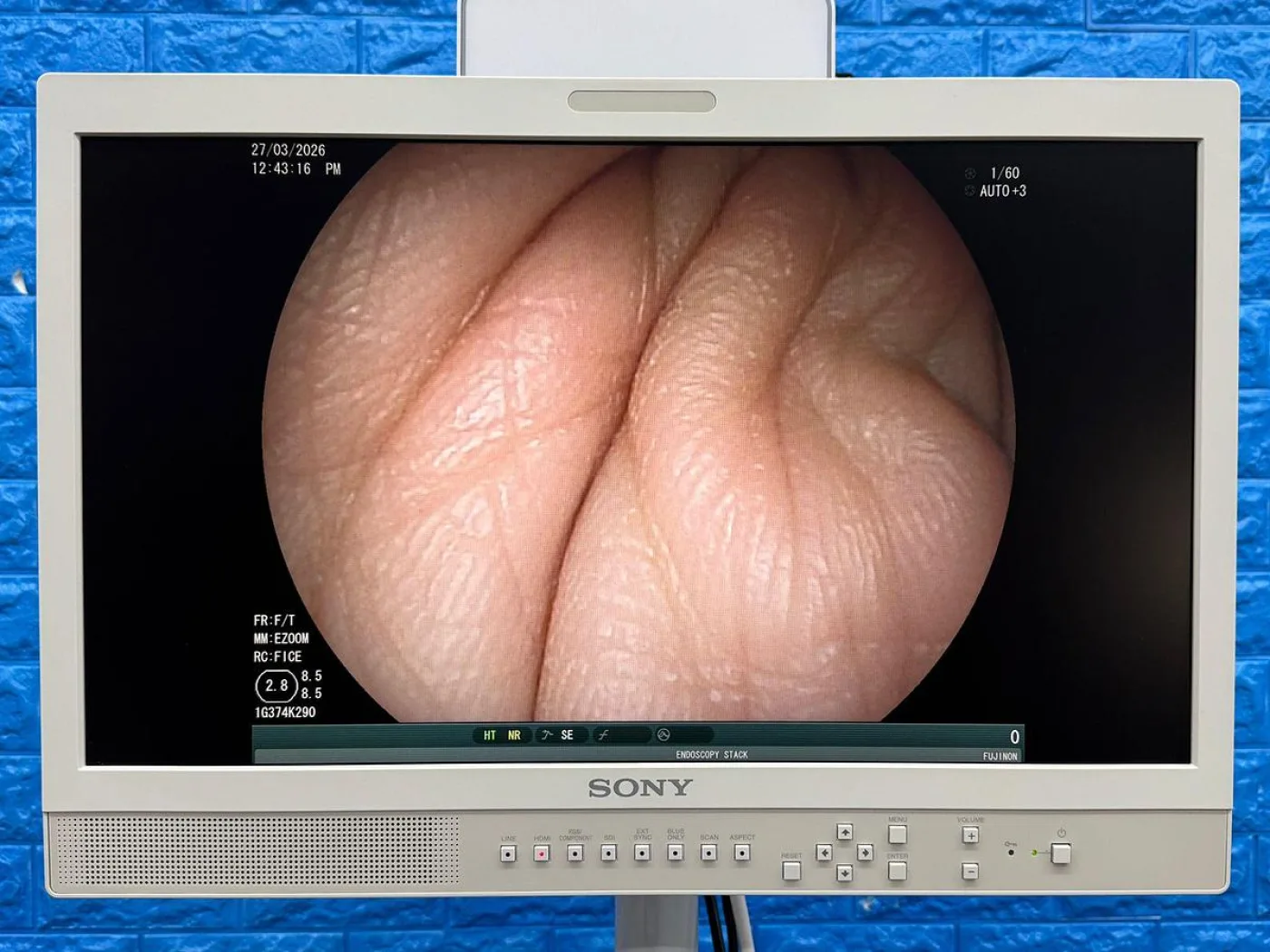 Fujinon Scope Model: EG-530FP Gastroscope - 2