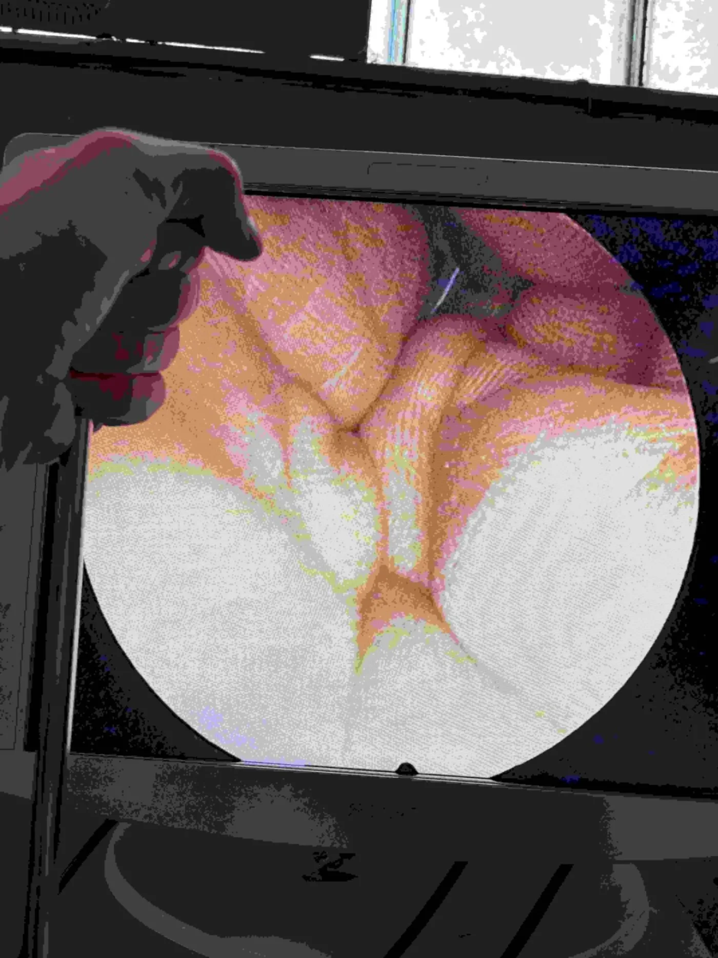 5512 CCD Endocam (Gebraucht, sehr gut) - 6