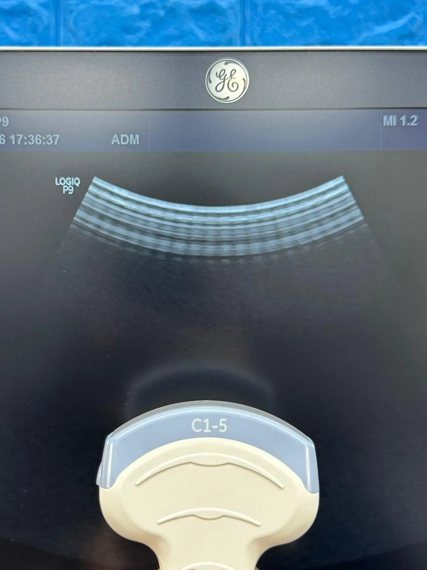 GE LOGIQ P9 YOM: 2016 R1 with Convex C1-5-RS YOM: 2022 and Linear Probe 9L-RS YOM: 2018 - 8