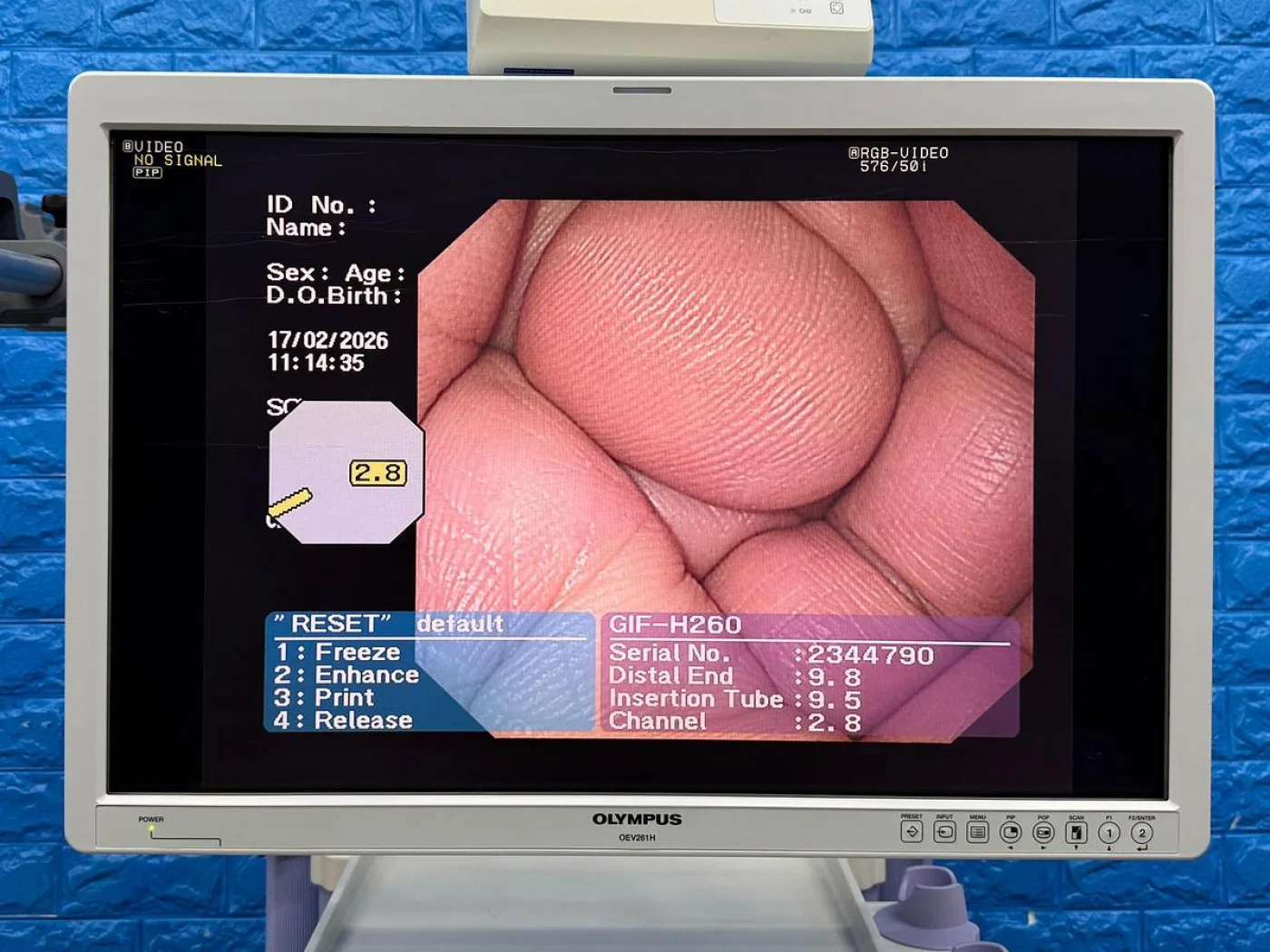 OLYMPUS CV-260SL Endoscopy Tower - 5