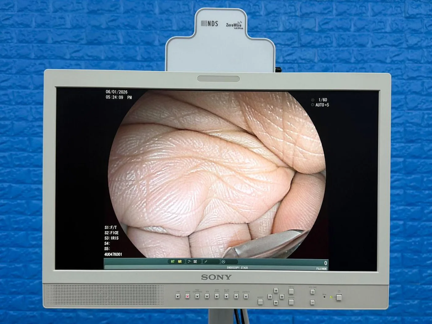 Fujinon Scope EG-580 UT Linear Ultrasonic Endoscope YOM: 2018 - 2
