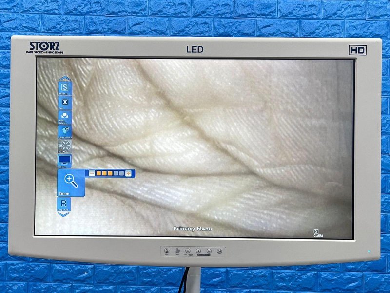 Karl Storz 13925 PKS Colonoscope