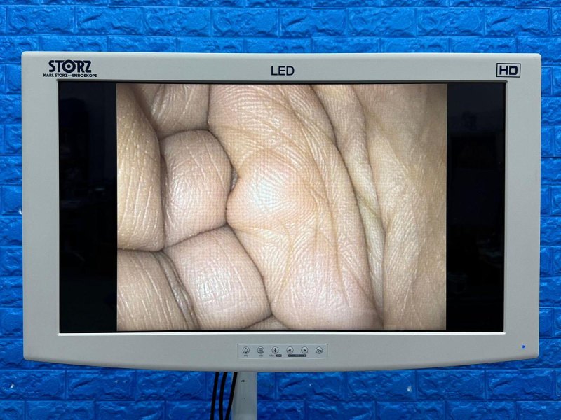 Karl Storz 13924 PKS Colonoscope