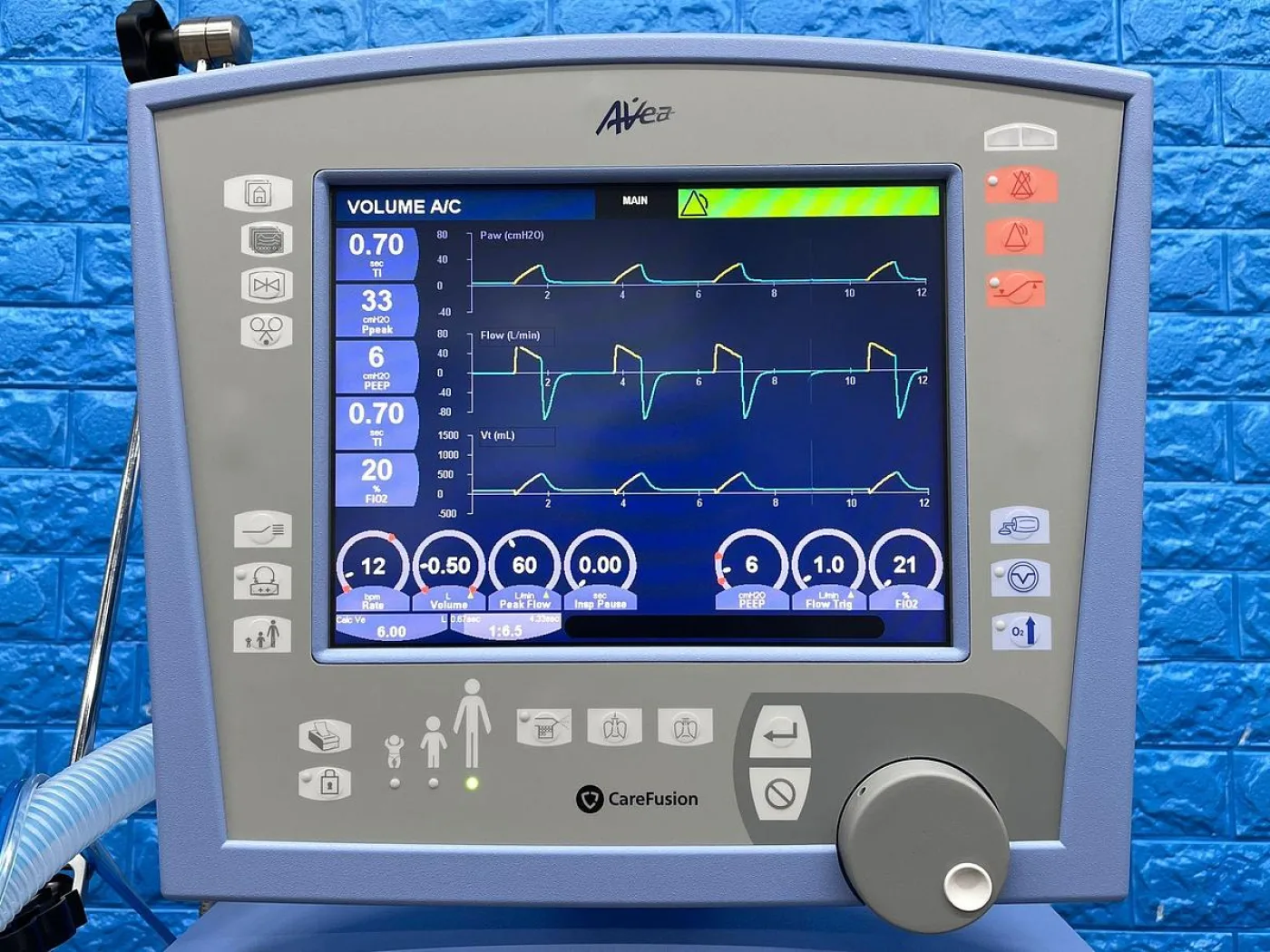 Viasys Avea Ventilator YOM: 2017 - 6