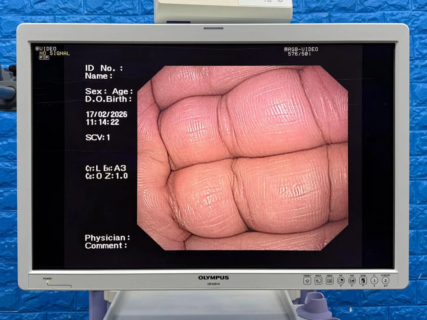 OLYMPUS CV-260SL Endoscopy Tower - 7