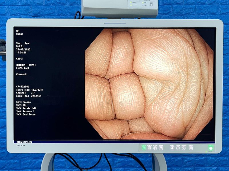 Olympus CF-HQ290L Colonoscope