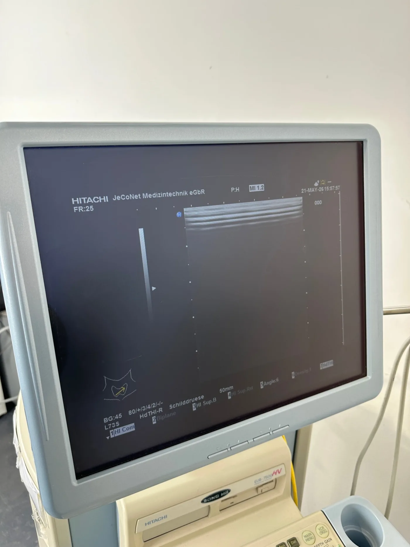 Hitachi EUB-7500A Ultraschallfarbdoppler inkl. 2 Sonden - 6