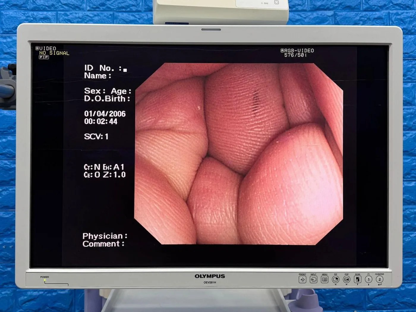 Olympus Scope Model: CF-Q260DL Colonoscope - 3