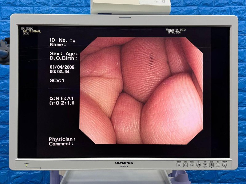 Olympus Scope Model: CF-Q260DL Colonoscope
