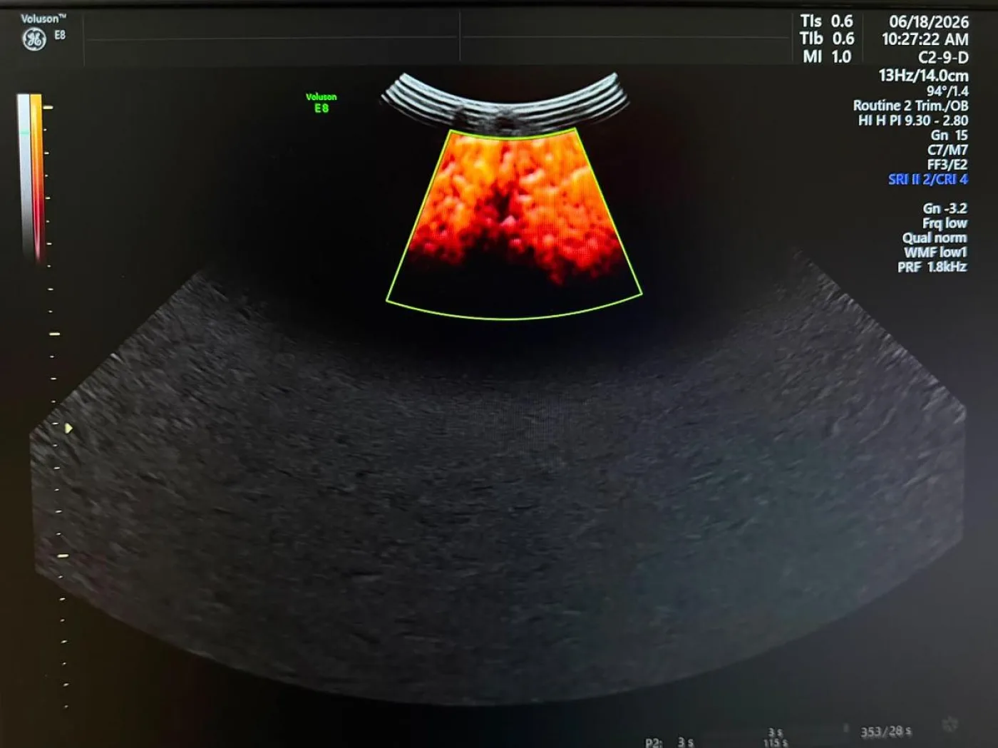 GE C2-9-D Probe REF: 5405253 YOM: 2019 - 4