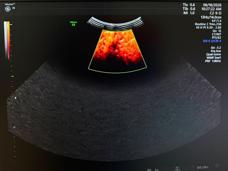 GE C2-9-D Probe REF: 5405253 YOM: 2019