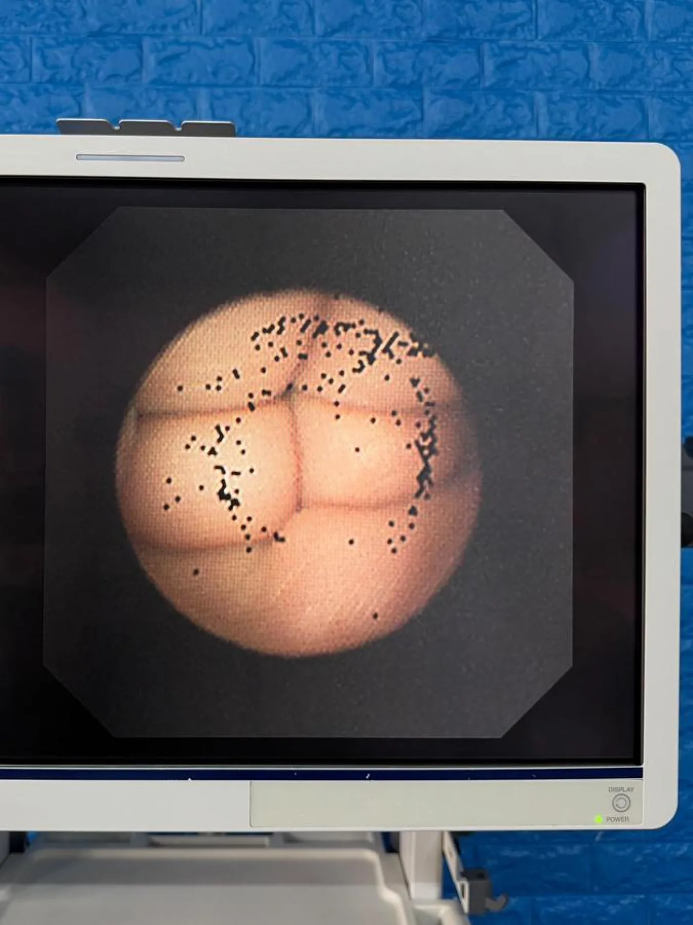 Olympus BF-UC260FW Linear Ultrasound Bronchoscope EBUS - 2