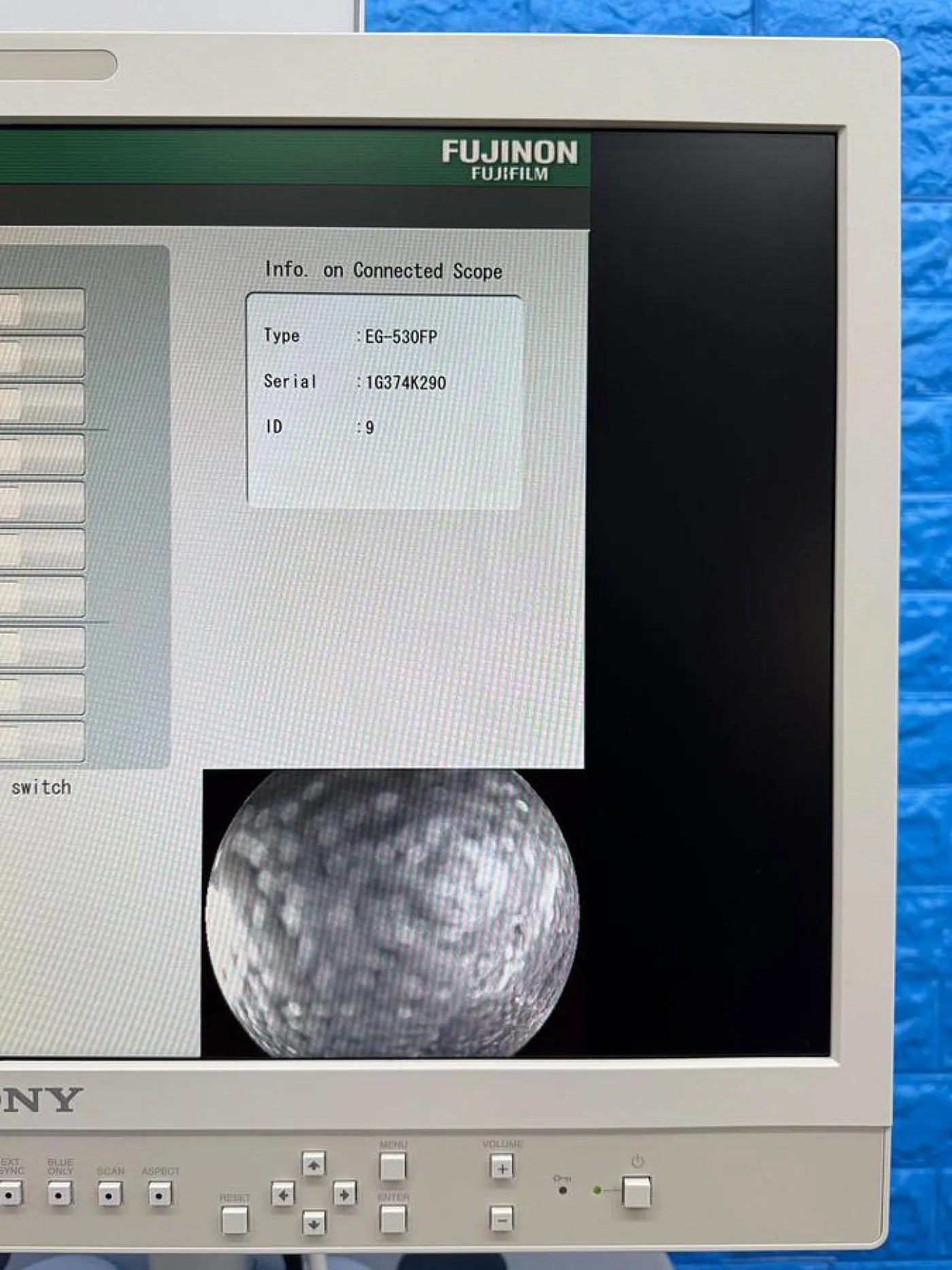 Fujinon Scope Model: EG-530FP Gastroscope - 5