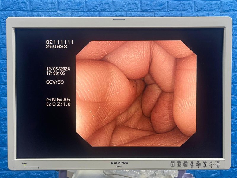 Olympus CF-H260DL Colonoscope