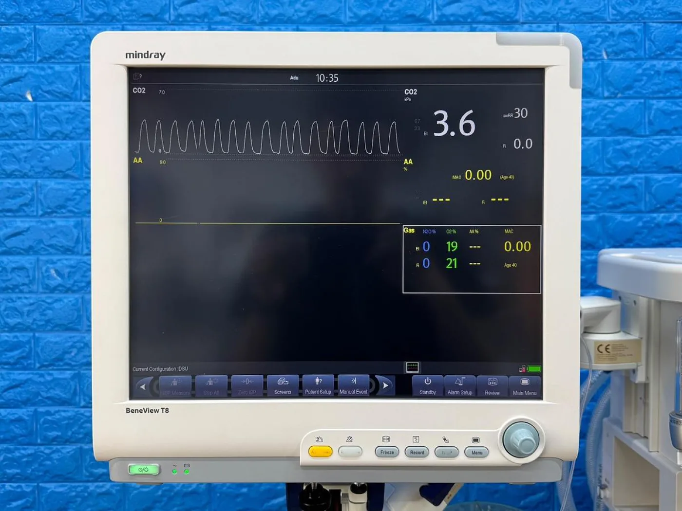 Mindray Wato EX-65 Anesthesia YOM: 2016 - 8