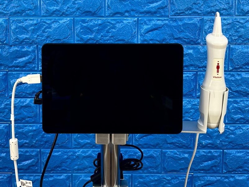 Vitacon VitaScan LT Urology Ultrasound With Vitascan V2 Probe.