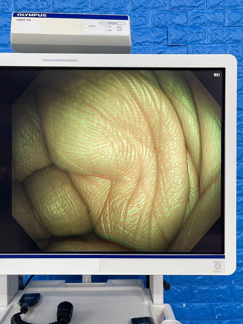Olympus Scope Model: CF-HQ290L
