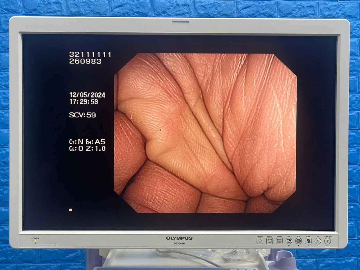 Olympus CF-H260DL Colonoscope - 3