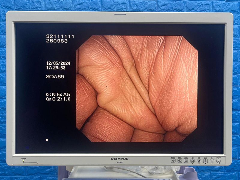 Olympus CF-H260DL Colonoscope