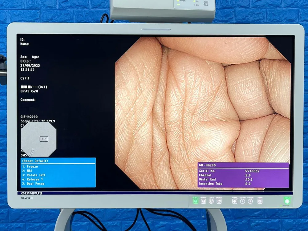 Olympus GIF-HQ290 Gastroscope