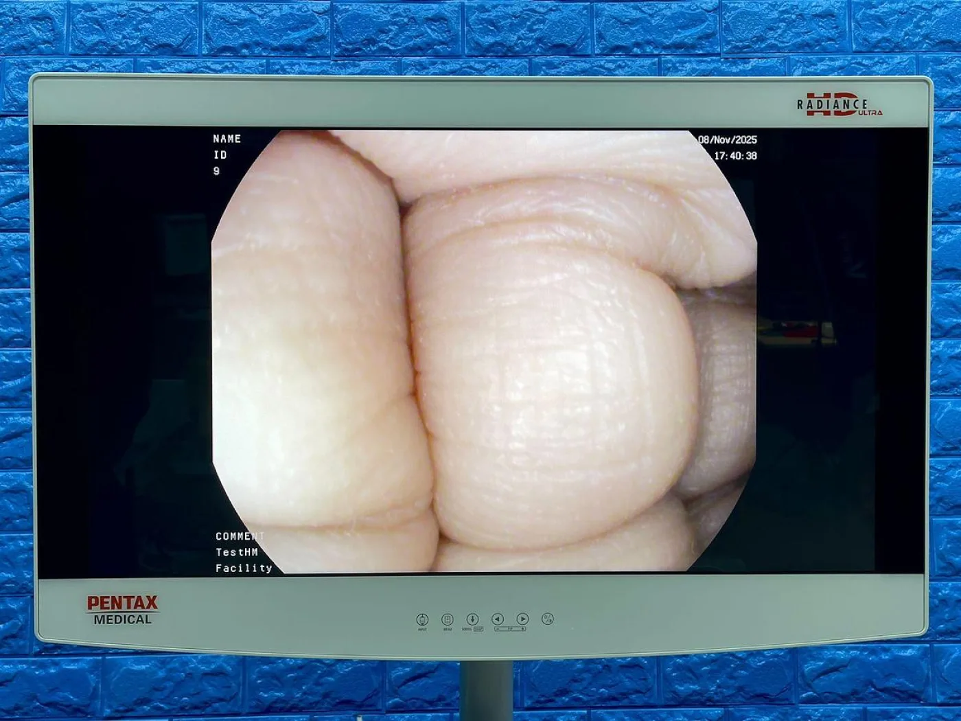 Pentax Scope Model: G-EYE38-i 10NL Colonoscope, YOM: 2019, 26 Times Used. - 2