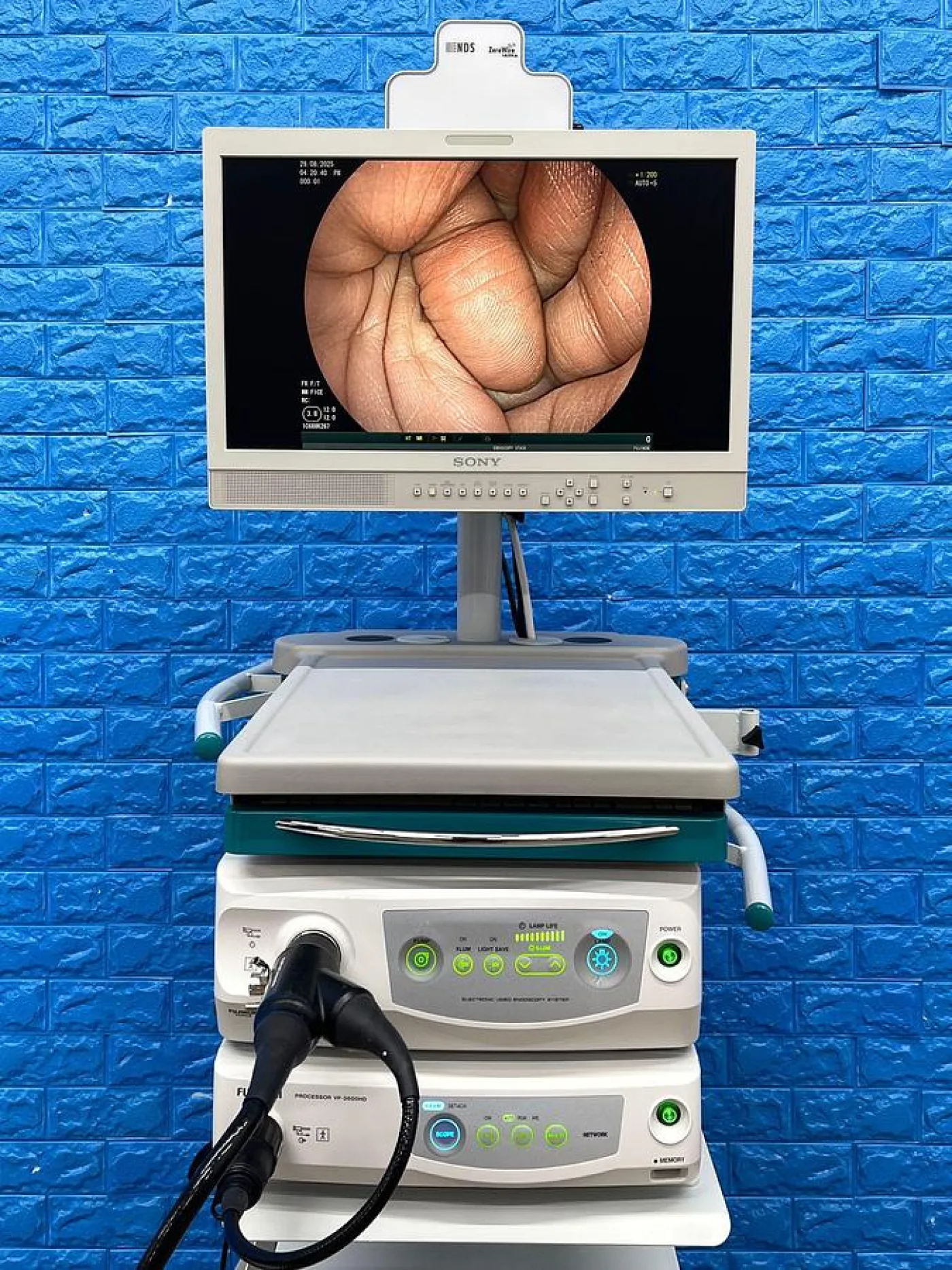 Fujinon VP-3500HD System with XL-4450 Light source Endoscopy System - 7