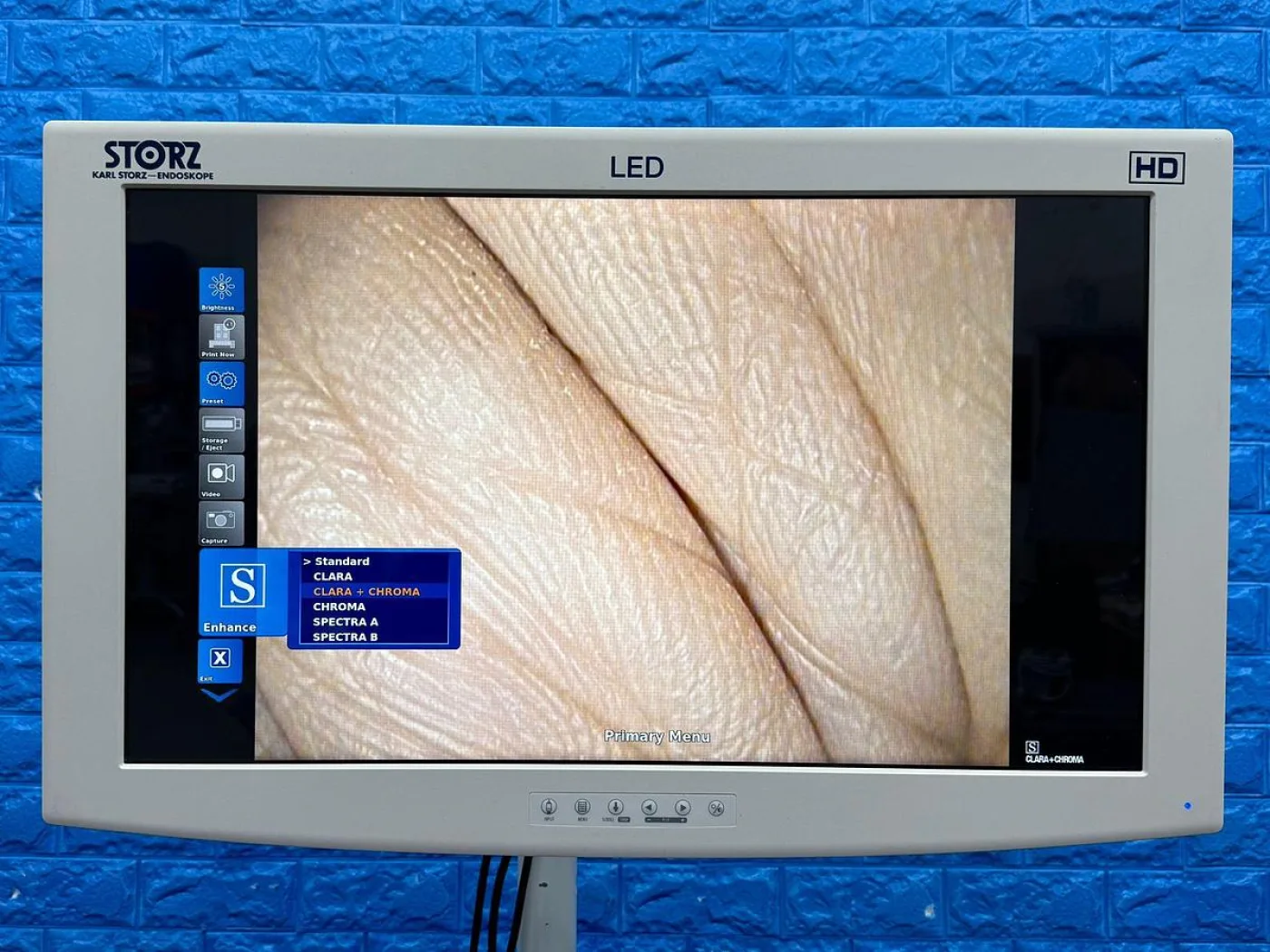 Karl Storz 13924 PKS Colonoscope - 4