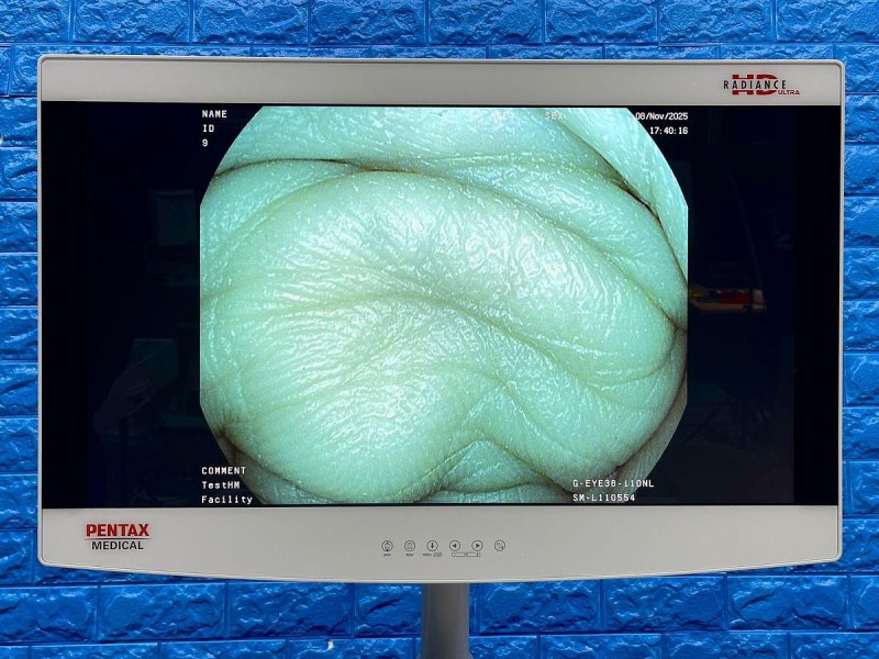 Pentax Scope Model: G-EYE38-i 10NL Colonoscope, YOM: 2019, 26 Times Used.