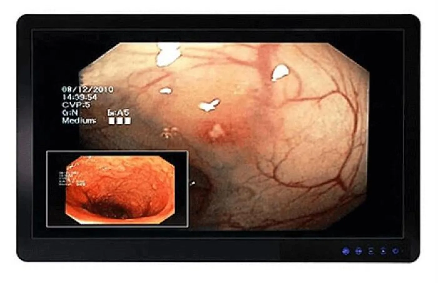 Medical monitor HD LED 24 inches - 1
