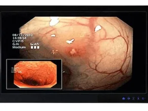 Medical monitor HD LED 24 inches