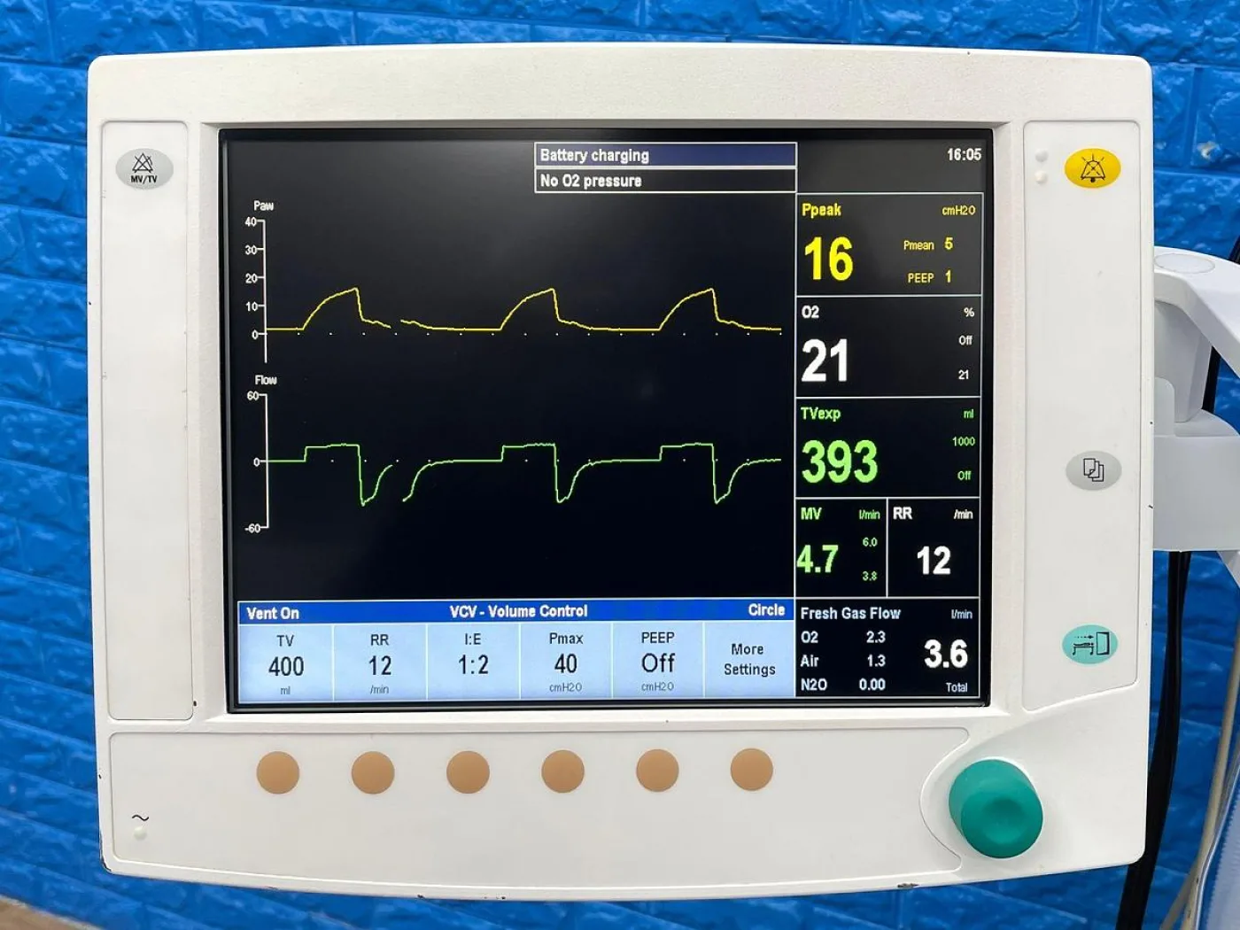 GE Datex-Ohmeda Aespire View YOM: 2015 REF: 1009-9212-000 - 7