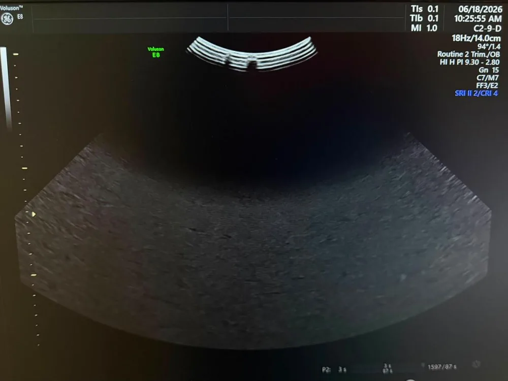 GE C2-9-D Probe REF: 5405253 YOM: 2019