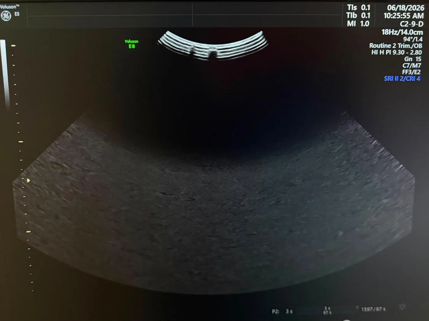 GE C2-9-D Probe REF: 5405253 YOM: 2019 - 1